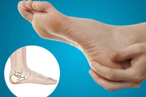 روش‌های درمان خار پاشنه