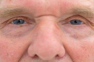 دلیل کوچک شدن چشم با افزایش سن