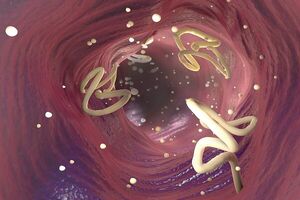 راه‌کارهای درمانی برای مقابله با انگل روده