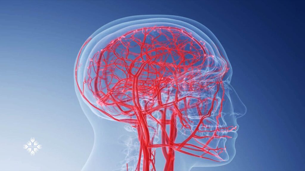 سردردهای خوشه‌ای در زنان شدیدتر است