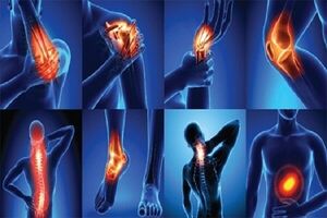 دلایل ایجاد آرتروز و راه‌های درمان آن