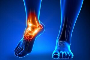 درد مچ پا چه زمانی خطرناک است؟