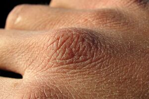 ۵ عادت غلط برای سلامت پوست