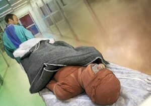 مرگ‌ومیر ناشی از سوختگی در آذربایجان‌شرقی ۳۳ درصد افزایش یافت